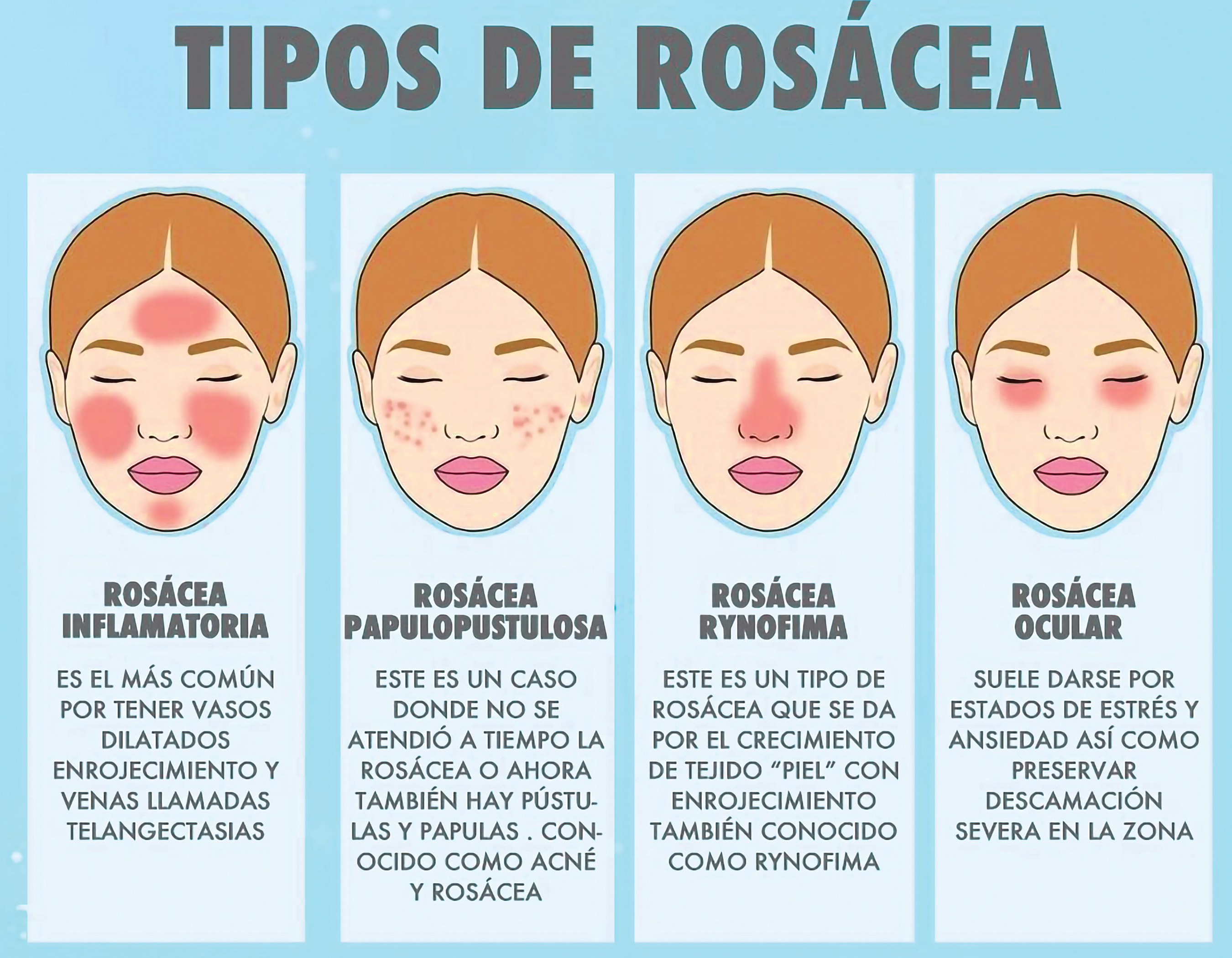 Un enemigo de tu piel
ROSÁCEA